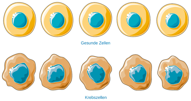 Gesunde Zellen und Krebszellen im Vergleich
